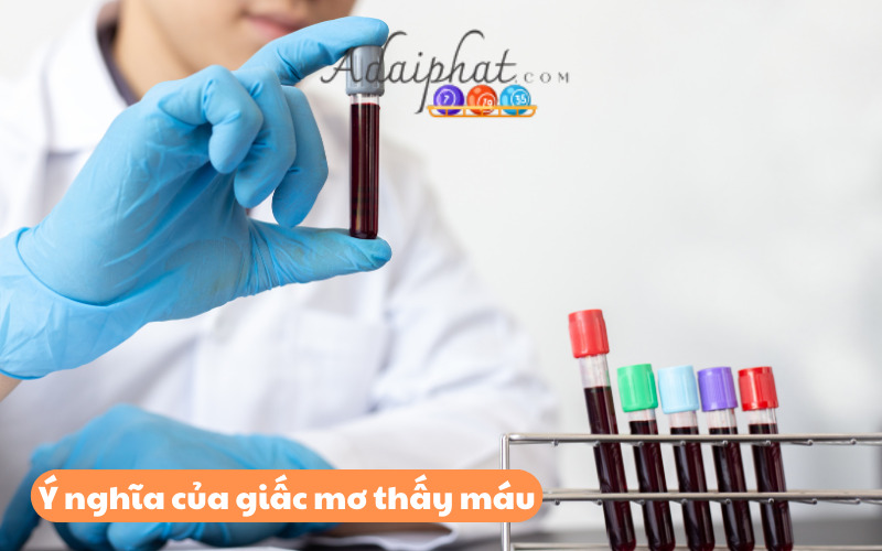 Ý nghĩa của giấc mơ thấy máu