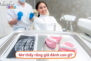 Mơ thấy răng giả là điềm báo gì? May mắn hay xui xẻo?